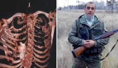 Patlamamış el bombası Rus askerin göğüs kafesine sıkıştı