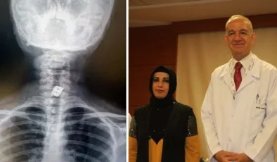 Boynuna takılan implant yemek borusunu yırtıp midesine düştü