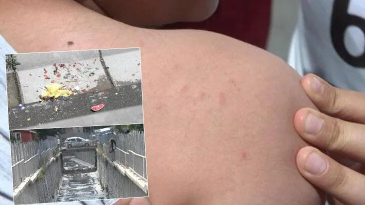 İstanbul’da sivrisinek tedirginliği! ‘Çocukları dışarı çıkaramıyoruz’