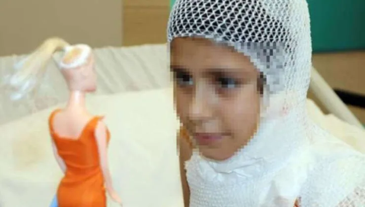 11 yaşındaki çocuk ‘kolonya yakma’ videosu çekerken ağır yaralandı