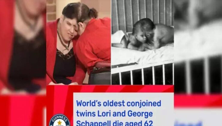 Dünyanın en yaşlı yapışık ikizleri öldü